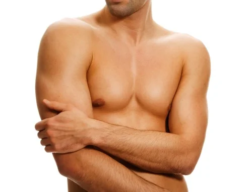 Imagen de Ginecomastia