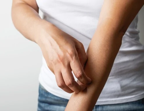 Imagen de Pruebas de alérgenos