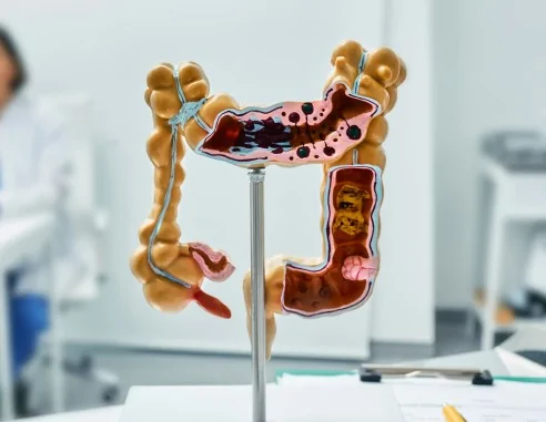 Imagen del producto Prueba de detección precoz de cáncer de colon | e-Quirónsalud