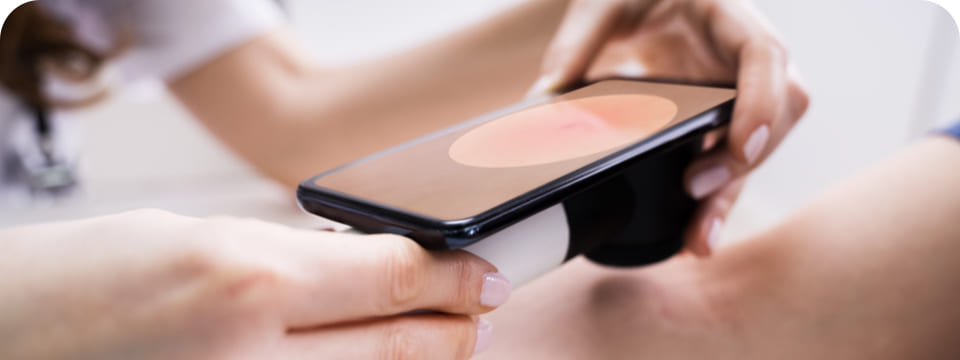 teledermatologia